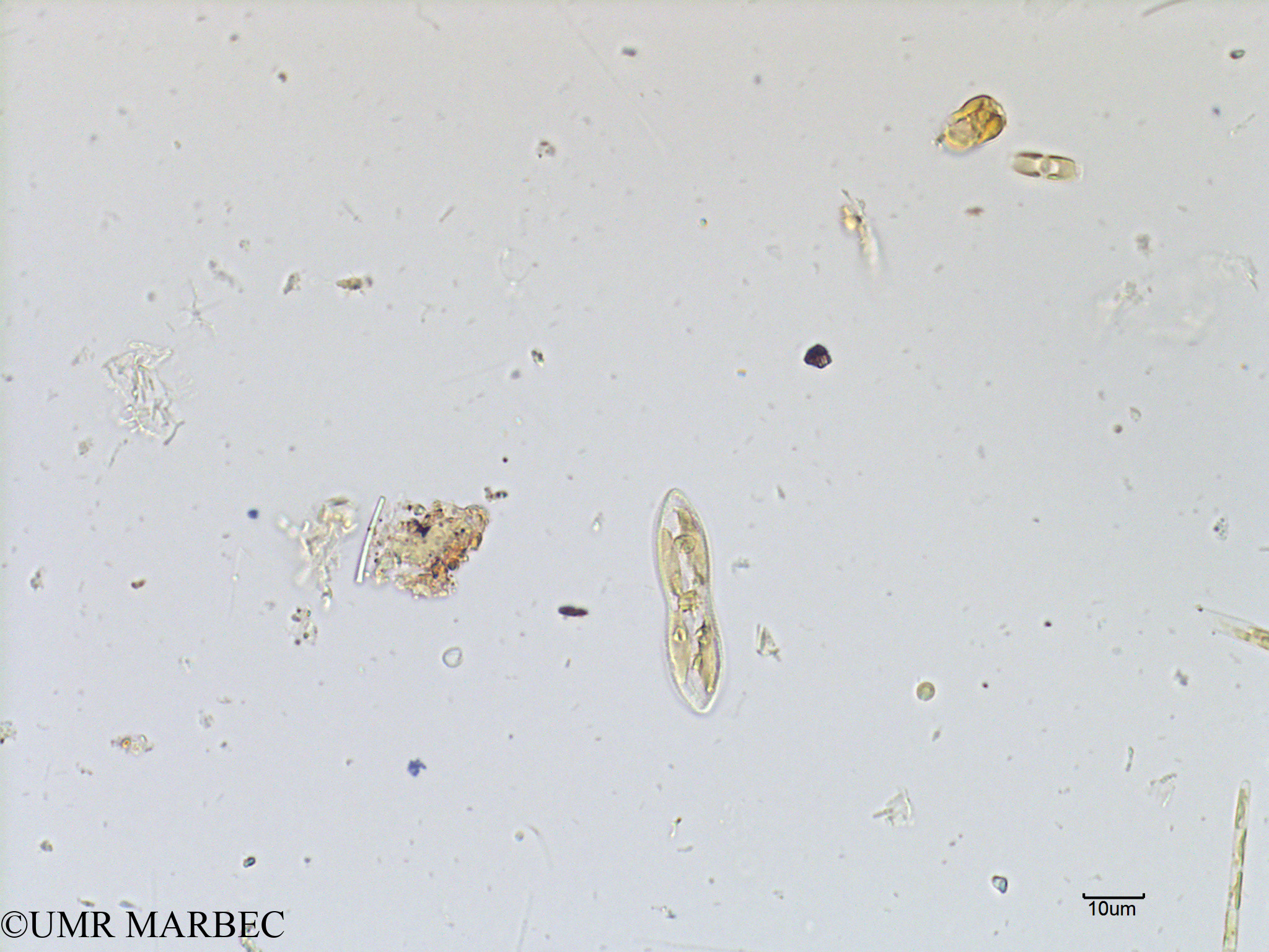 phyto/Scattered_Islands/mayotte_lagoon/SIREME May 2016/Diploneis spp (old Navicula sp17 -MAY5_diploneis-3).tif(copy).jpg
